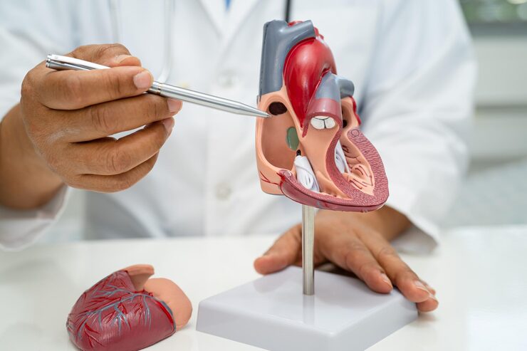CABG Surgery
