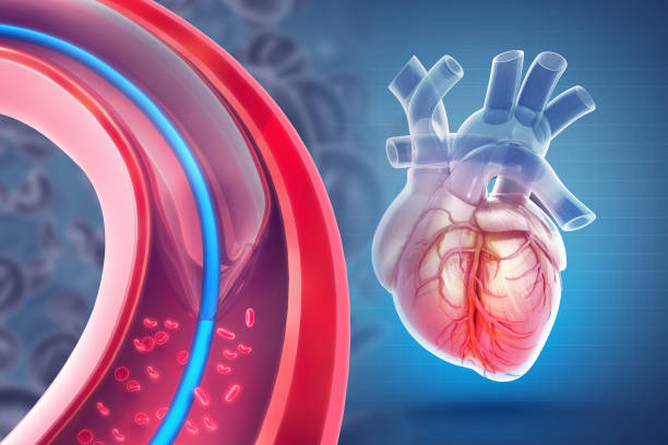 Peripheral Interventions In Cunningham Road
