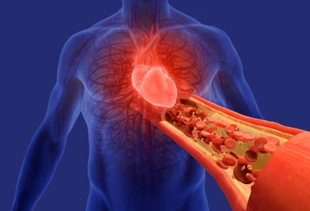 Hypertension Treatment In Cunningham Road